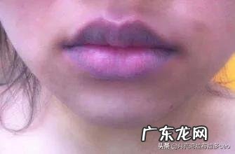 气滞、气虚、痰湿、体寒,都会造成血瘀体质,怎样调理血瘀?