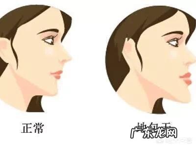 多大年纪做牙齿矫正比较好?