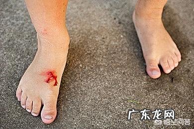 缺锌的宝宝会有哪八大特征？