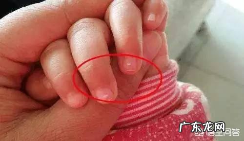 缺锌的宝宝会有哪八大特征？