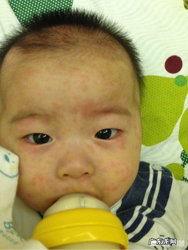 得幼儿急疹后，在护理时应该注意些什么问题？