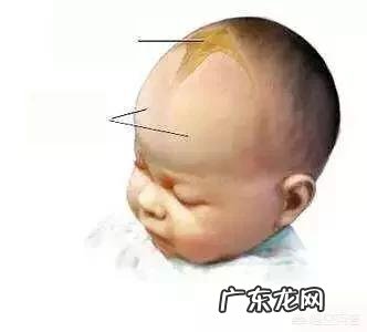 新生儿的囟门如何正确护理?