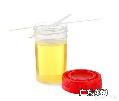 肾功能检测主要有哪些项目呢?