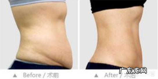 产后怎么恢复紧致的腹部呢?