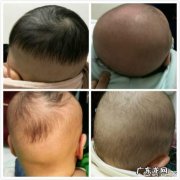如何处理新生儿理发？