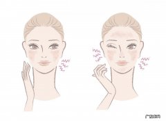 如何改善皮肤粗糙