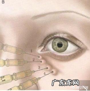 因为熬夜出现黑眼圈和泪沟怎么办?