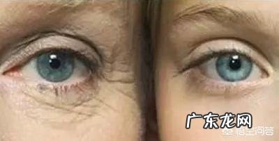 眼角有皱纹该怎么办?
