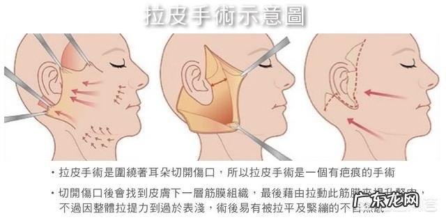眼角有皱纹该怎么办？