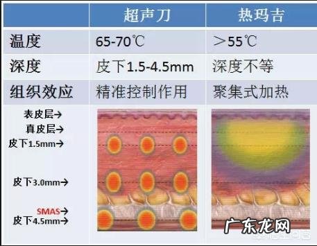 眼角有皱纹该怎么办？