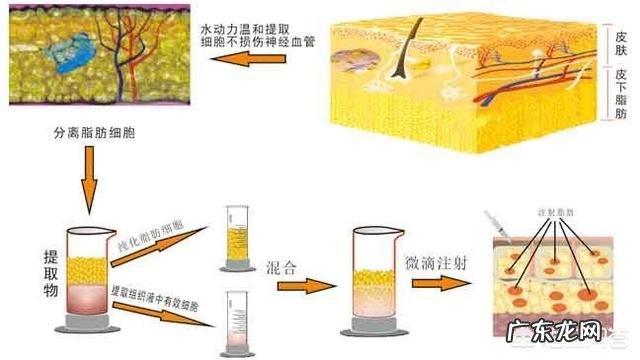 眼角有皱纹该怎么办?