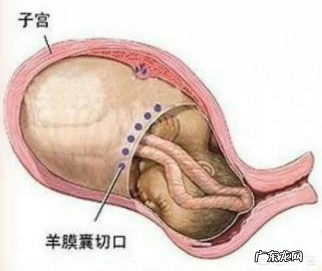 怀孕32周了,如果胎儿已经入盆,孕妇会有什么感觉呢?