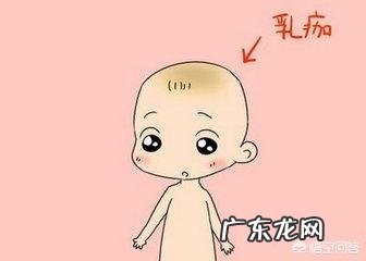 新生儿皮肤护理:胎垢、脱皮、腌脖子、肚脐腋下护理都有哪些?