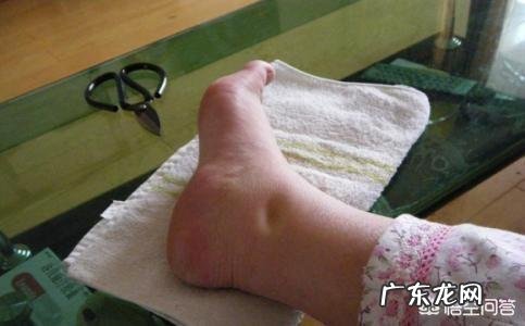 孕期鞋要买大一码吗?