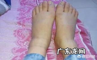 孕期鞋要买大一码吗?