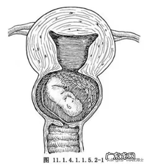 什么情况会子宫颈受孕?