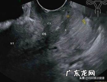 什么情况会子宫颈受孕?