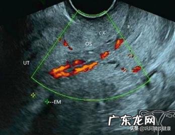 什么情况会子宫颈受孕?