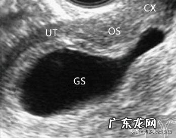 什么情况会子宫颈受孕?