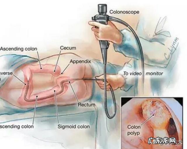 肠道不好有什么危害?该怎样调理?