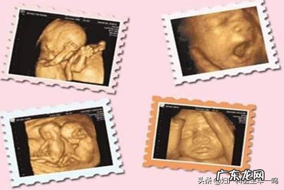 三维彩超和四维彩超有什么区别?做哪个好?