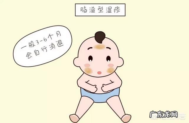 我家宝宝两个多月了，脸上湿疹反反复复，有没有一款好点的婴儿湿疹膏？