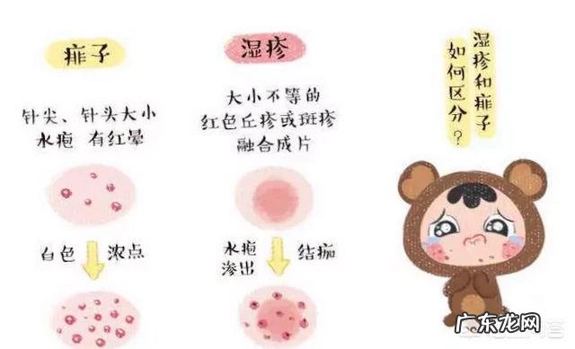 我家宝宝两个多月了，脸上湿疹反反复复，有没有一款好点的婴儿湿疹膏？