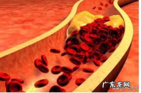 高血脂不能吃什么水果?