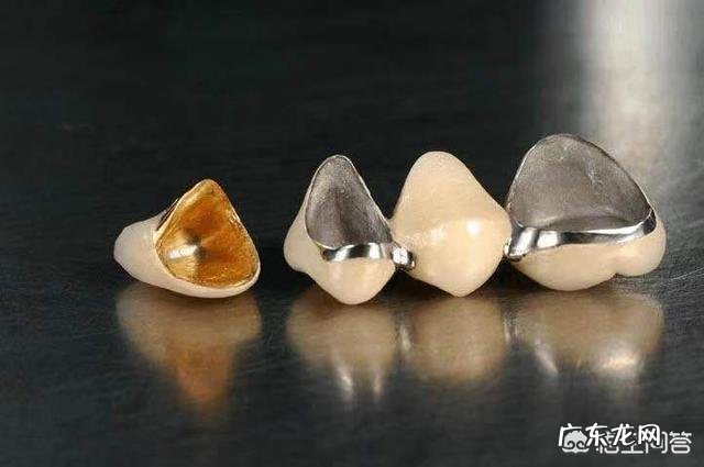 烤瓷牙有哪些危害?