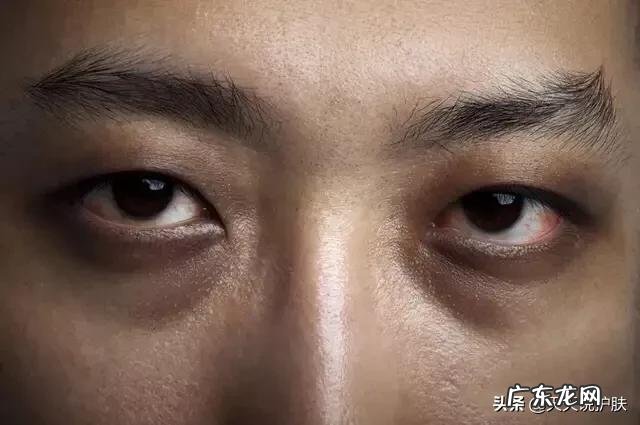 如何让自己的皮肤慢慢变好?