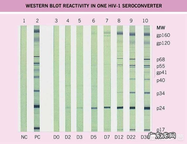 在家测艾滋靠谱吗?
