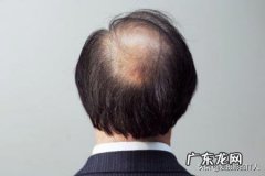 秃顶会遗传吗？有哪些科学依据？