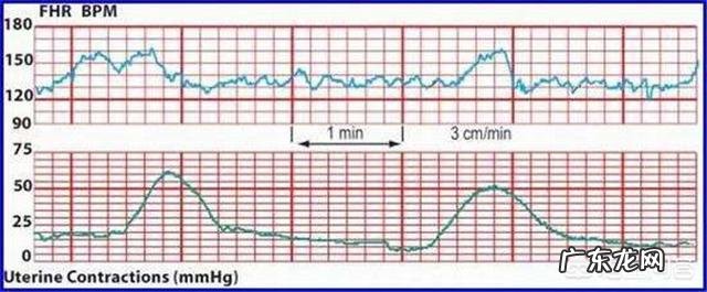 预产期过了打催产针是不是比自然宫缩痛?