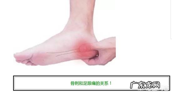 隐隐感觉足跟痛,时有时无,是怎么回事?