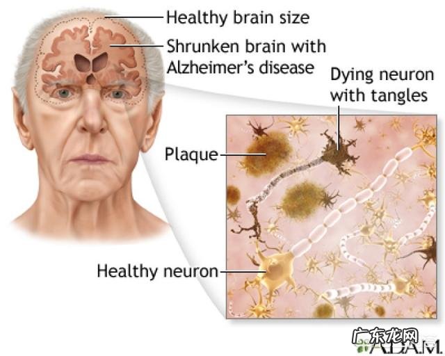 如何才能提高记忆力,吃什么会有帮助?