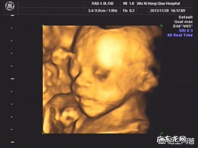 孕期什么时候最适合做四维?该注意什么?