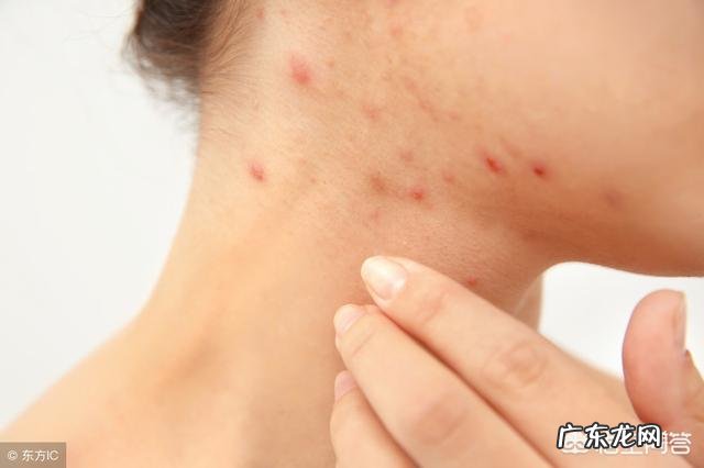 抗过敏药氯雷他定和扑尔敏有什么区别吗?