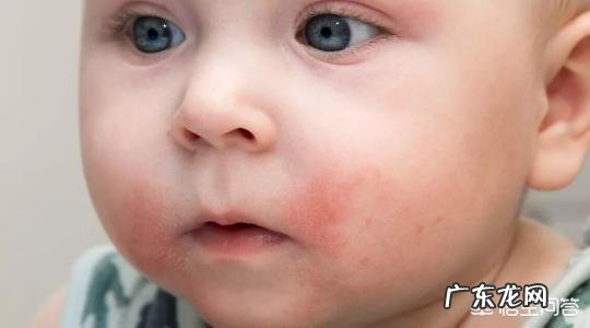 抗过敏药氯雷他定和扑尔敏有什么区别吗?