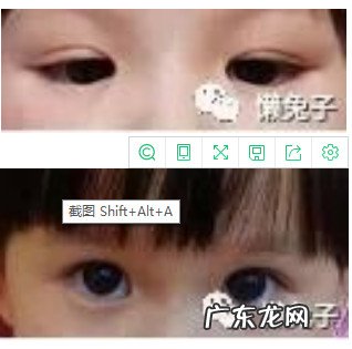 巧用蒲公英治孩子眼睛肿胀医案