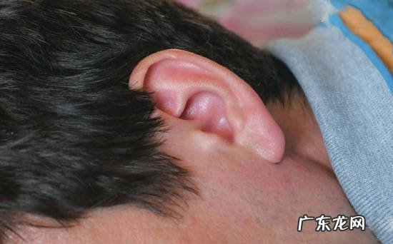 看耳垂可判断有无心脏疾患?