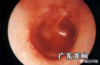 宝宝中耳炎有什么表现?