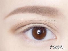 什么样的双眼皮比较好看？