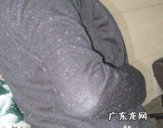 洗衣服时沾上许多毛毛怎么处理？