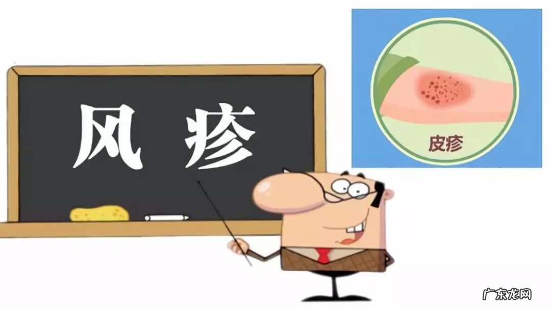 关于风疹的一些基本常识 过敏性风疹症状图片