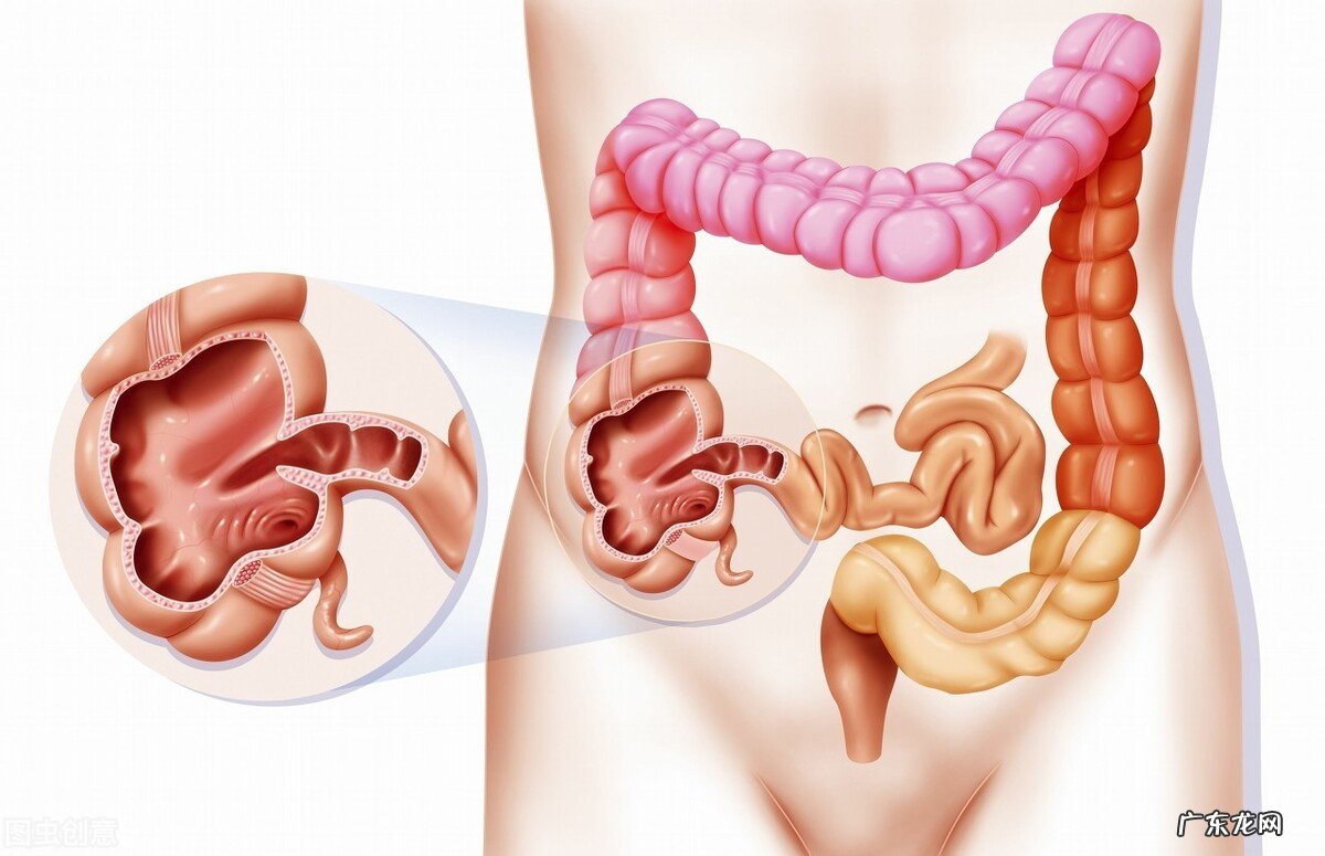 结肠癌多是拖出来的身体的这个信号或许早已告诉你 结肠癌症状