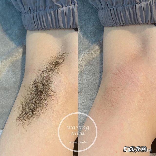 腋下要怎么美白?