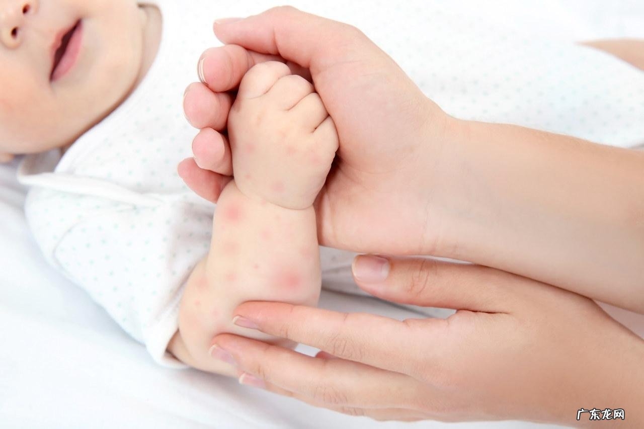 高烧38.6度退烧小妙招 大人退烧好办法6个退烧小妙招