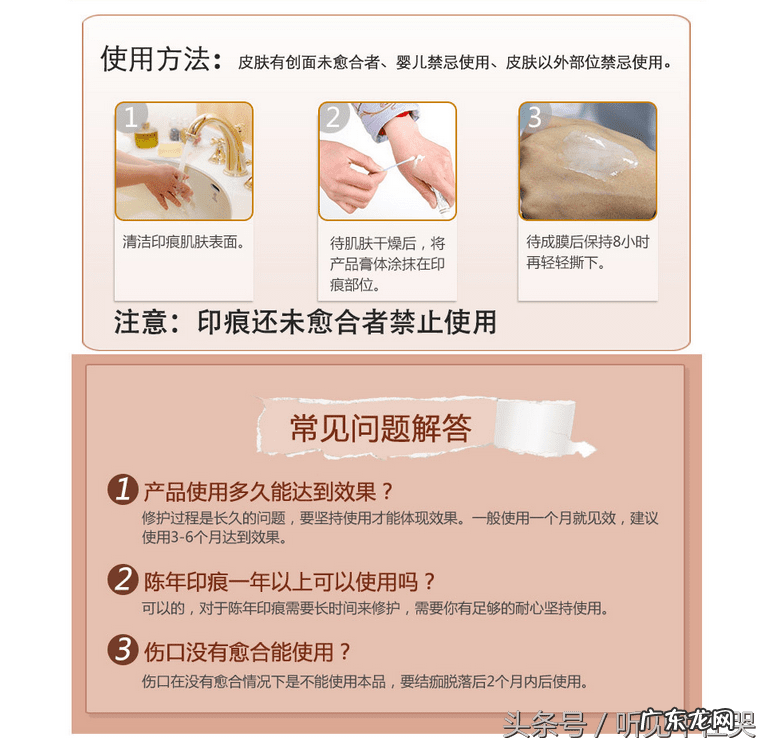 疤痕增生刚开始出现怎么消除 疤痕如何消除