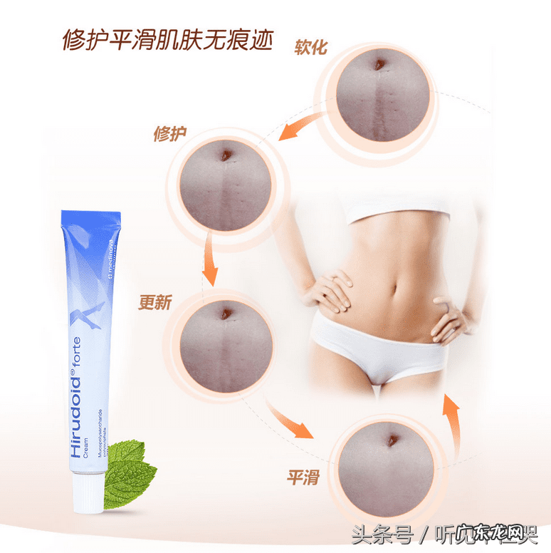 疤痕增生刚开始出现怎么消除 疤痕如何消除