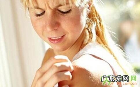 含有皮质类固醇激素的药膏有哪些 皮质类固醇激素药膏功效